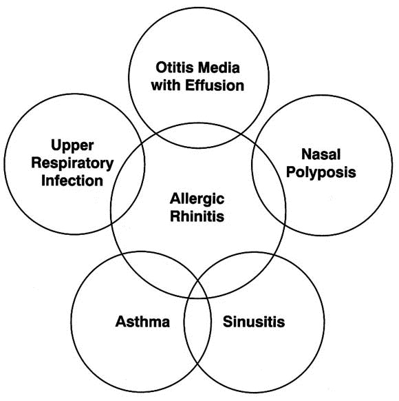 Diagram showing comorbid conditions associated with allergic rhinitis, including sinusitis, asthma, nasal polyposis, otitis media with effusion, and upper respiratory infection